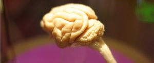 miniature sample of a human brain