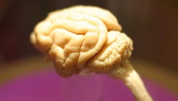 miniature sample of a human brain