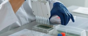 close-up of scientist using multi-channel pipette
